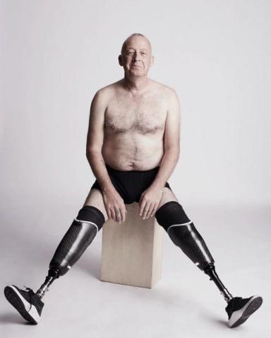 Η εμβληματική φωτογράφιση που αποδεικνύει πως η ομορφιά δεν μετριέται στα σημάδια Η εμβληματική φωτογράφιση που αποδεικνύει πως η ομορφιά δεν μετριέται στα σημάδια