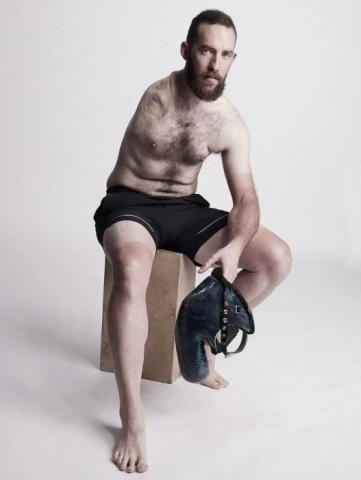 Η εμβληματική φωτογράφιση που αποδεικνύει πως η ομορφιά δεν μετριέται στα σημάδια Η εμβληματική φωτογράφιση που αποδεικνύει πως η ομορφιά δεν μετριέται στα σημάδια